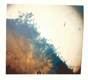 Fig. 2 - Fructifications of "Our fungus" on the cuticle of Dendroctonous ponderosae grubs at 100x.